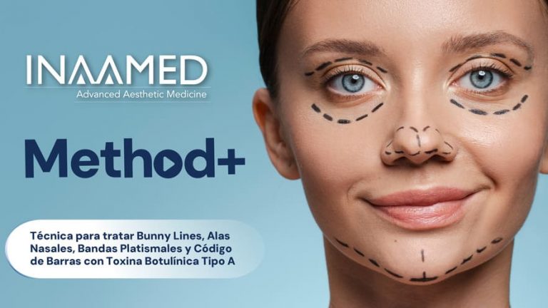 Técnica para tratar Bunny Lines, Alas Nasales, Bandas Platismales y Código de Barras con Toxina Botulínica Tipo A