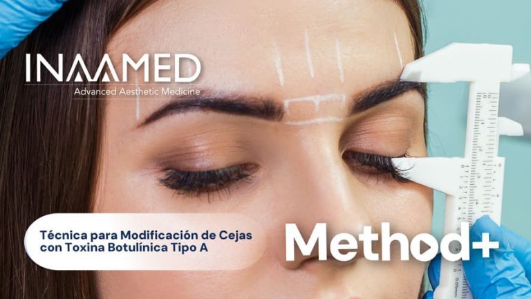 Técnica para Modificación de Cejas con Toxina Botulínica Tipo A