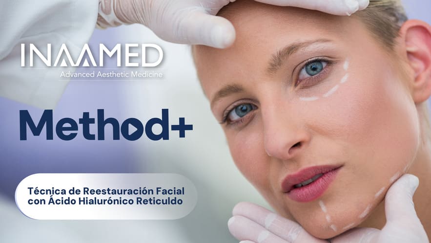 Técnica de Reestructuración Facial con Ácido Hialurónico Reticulado