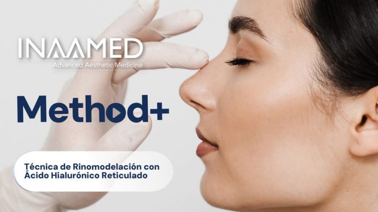 Técnica de Rinomodelación con Ácido Hialuronico Reticulado
