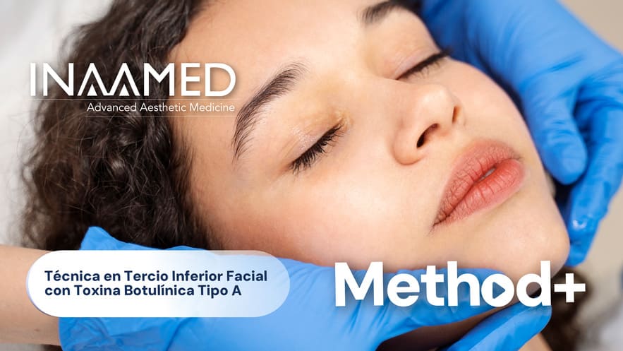 Técnica en Tercio Inferior Facial con Toxina Botulínica Tipo A
