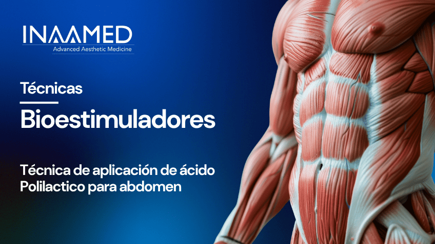 Bioestimuladores PLLA Abdomen