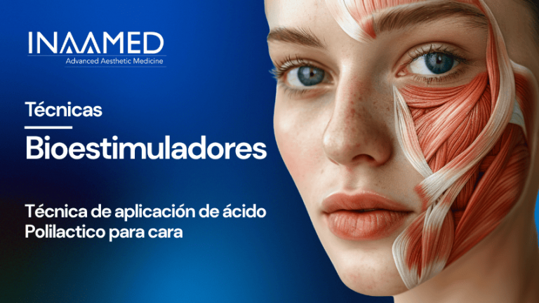 Bioestimuladores PLLA Facial