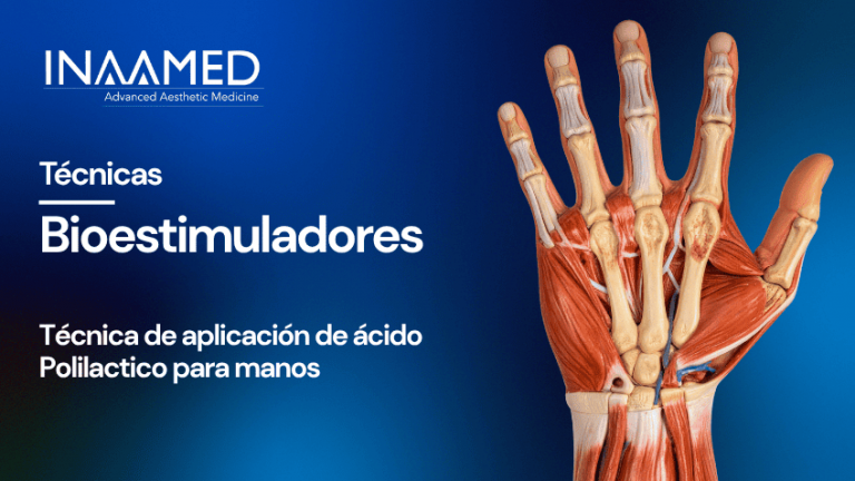 Bioestimuladores PLLA Manos