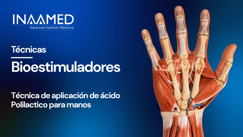 Bioestimuladores PLLA Manos